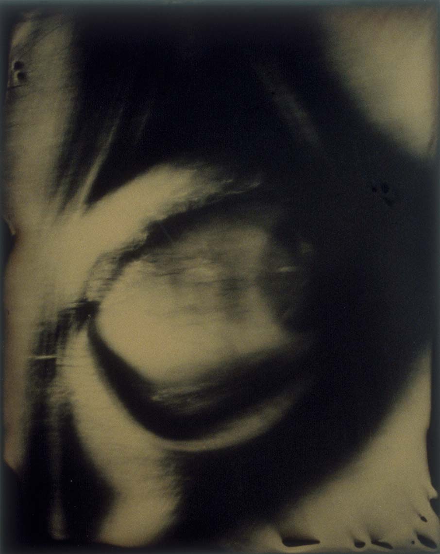 08_neurasthenia.jpg