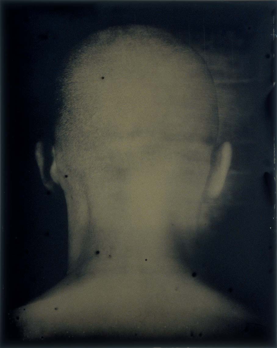 09_neurasthenia.jpg