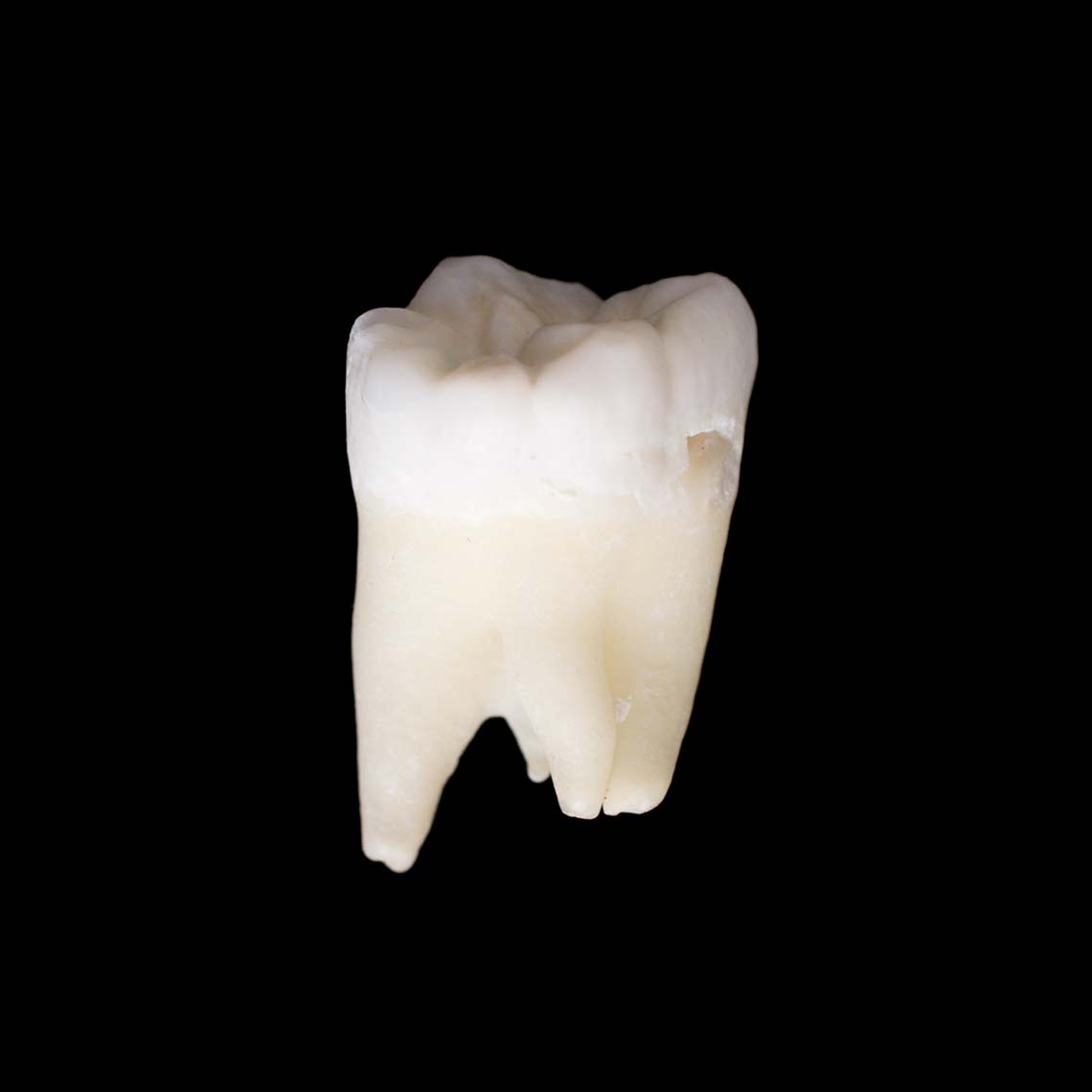 molar_7426.jpg