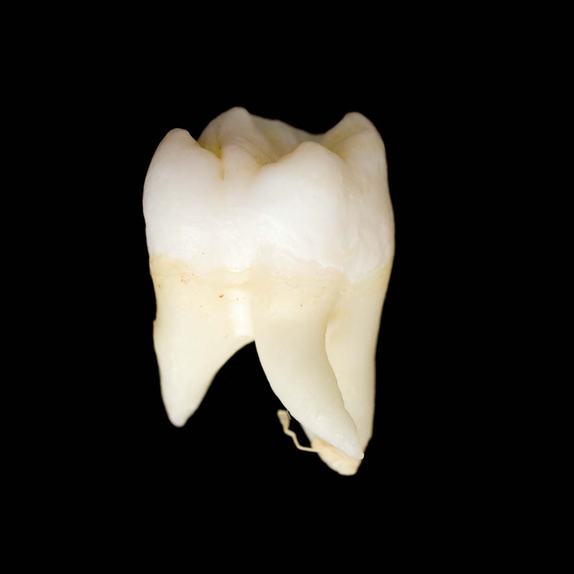 molar_7434.jpg
