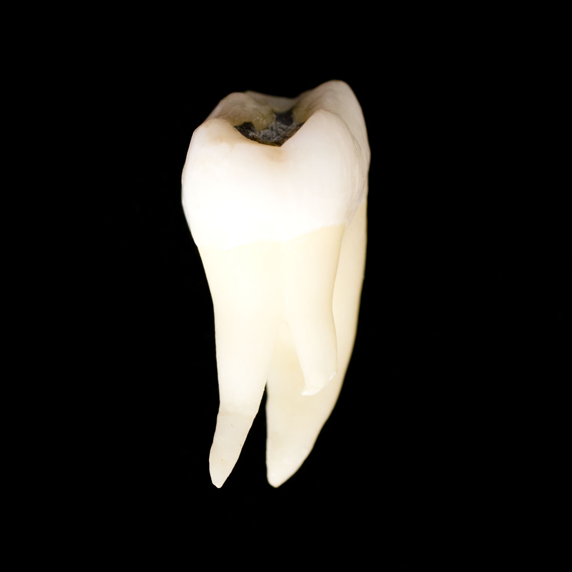 molar_7439.jpg