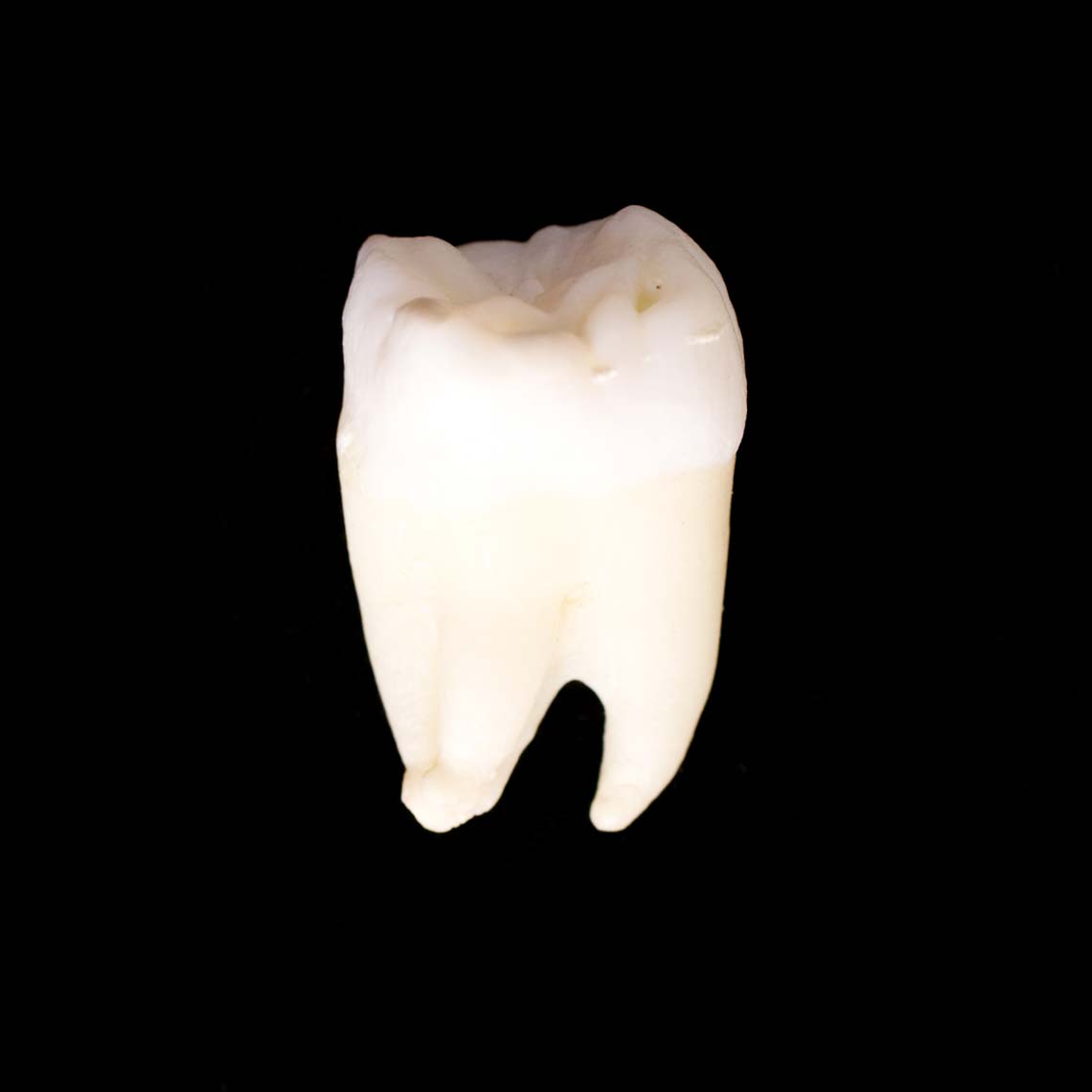 molar_7450.jpg