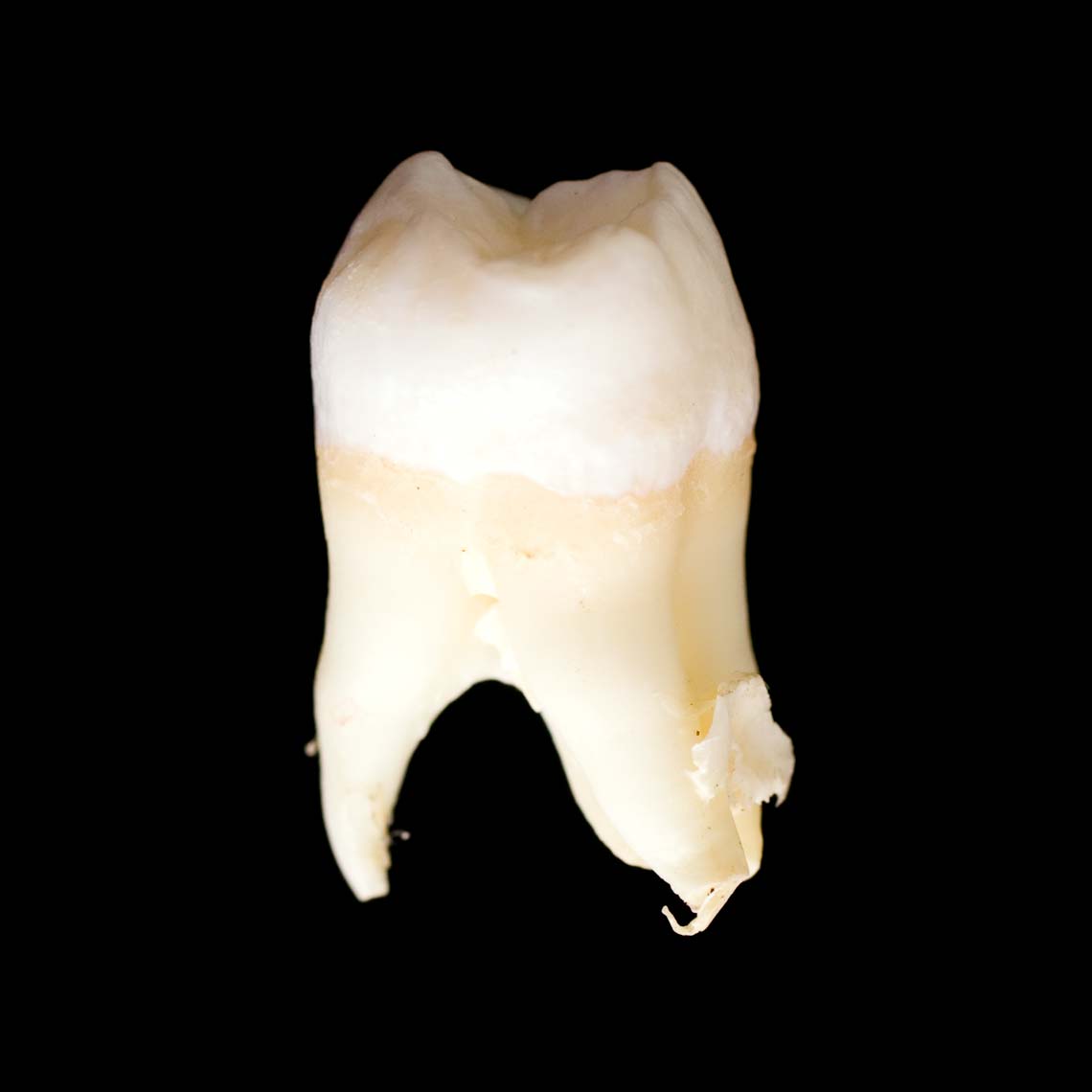 molar_7453.jpg