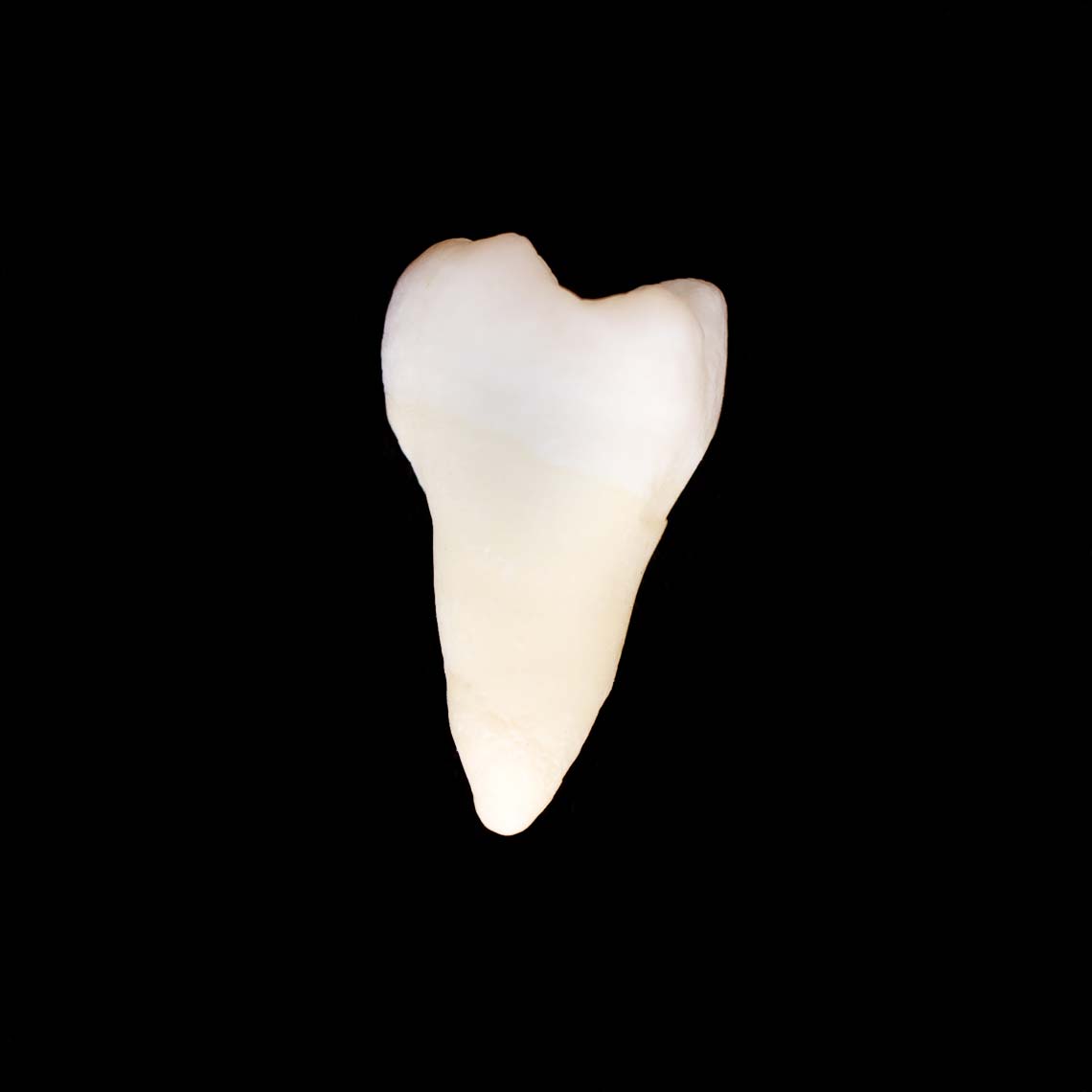 molar_7479.jpg
