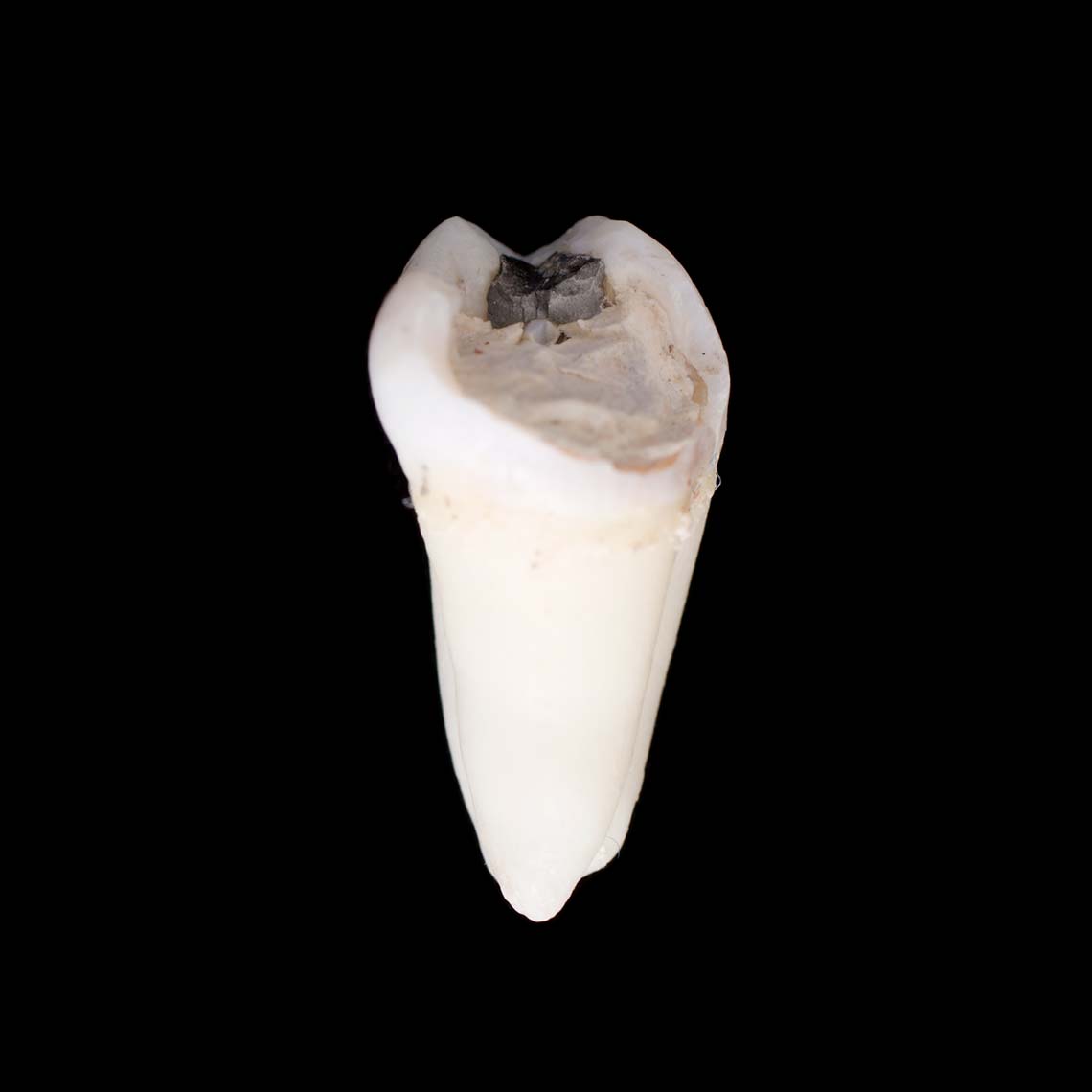 tooth_7422.jpg
